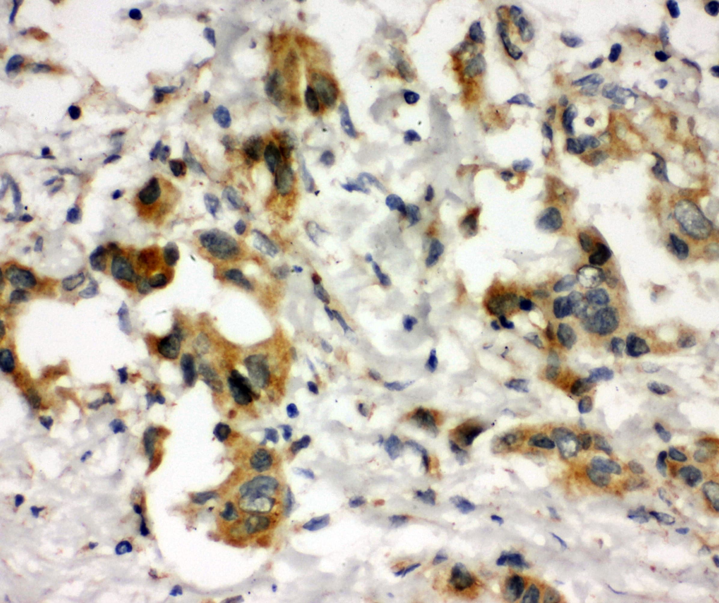 COMT Antibody (aa94-108)
