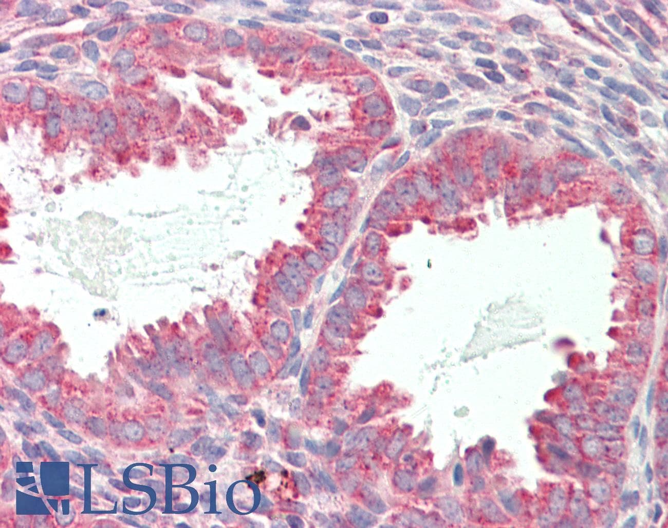 IHC-plus™ Polyclonal Rabbit anti-Human TMPRSS3 Antibody (aa420-460, IHC, IF, WB)