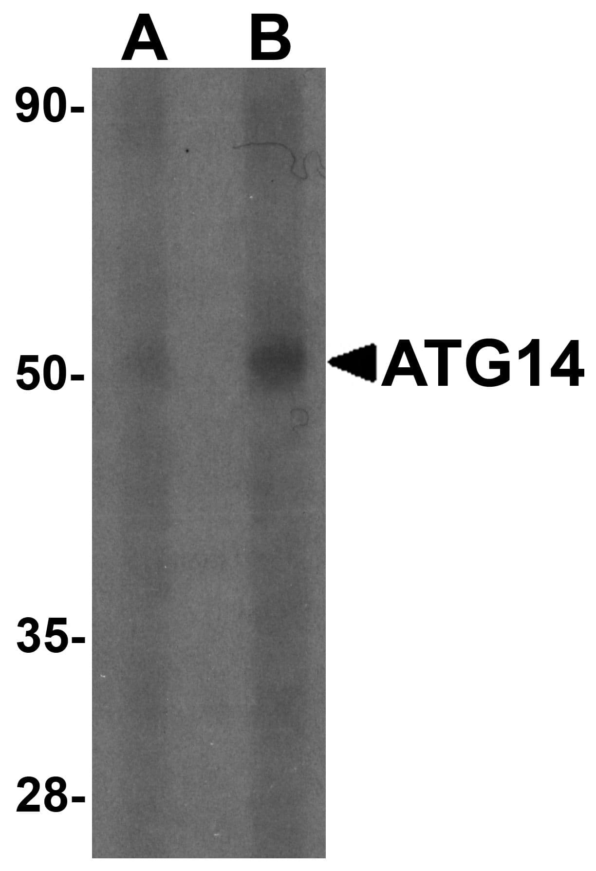 IHC-plus™ Polyclonal Rabbit anti-Human ATG14 Antibody (IHC, IF, WB)