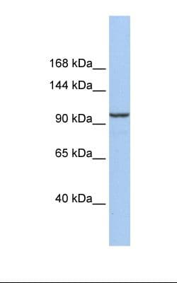 KLB / Beta Klotho Antibody (Internal)