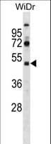 Polyclonal Rabbit anti-Human SPT7L / SUPT7L Antibody (aa186-214, WB)