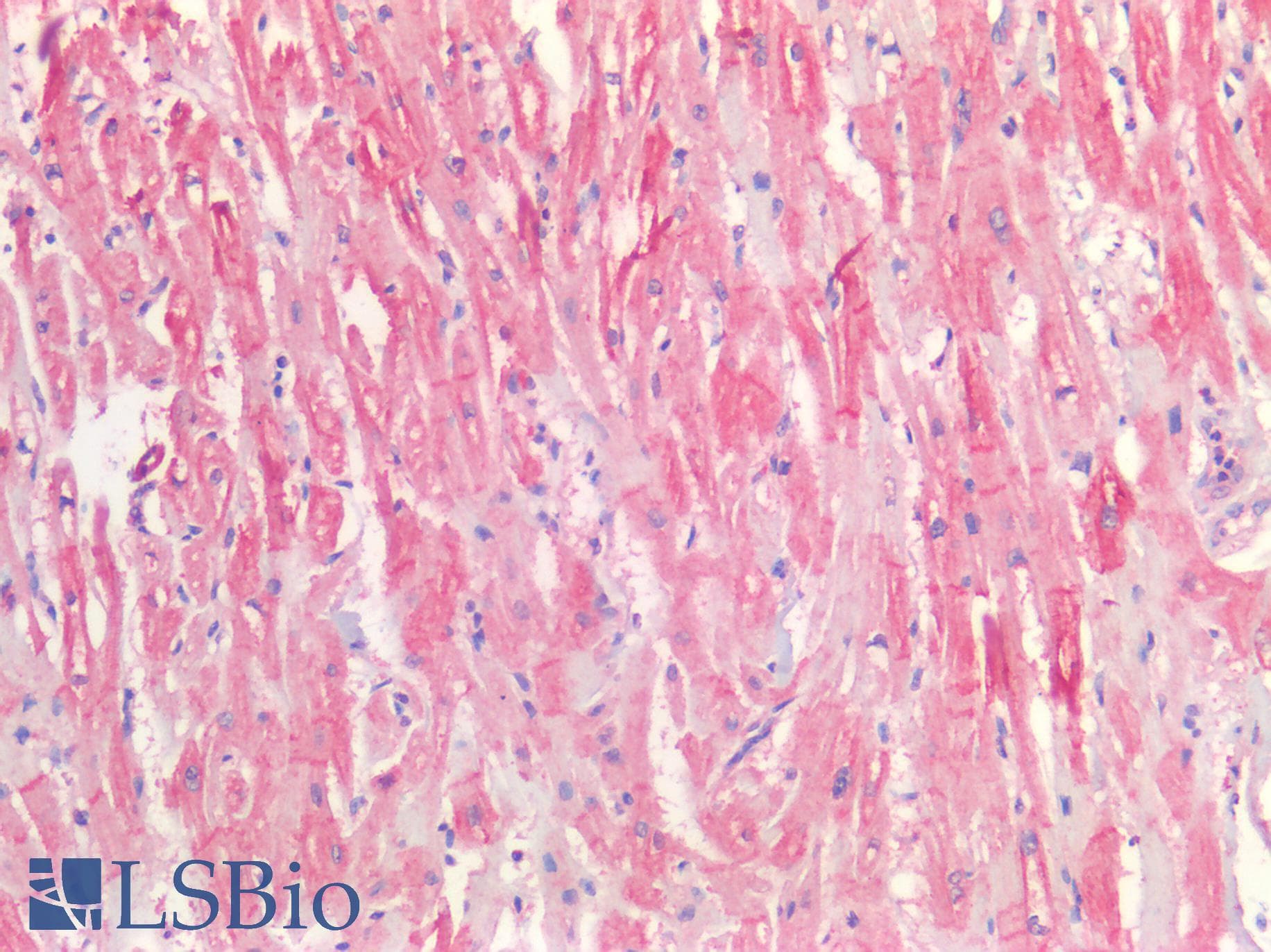 IHC-plus™ Polyclonal Rabbit anti-Human CD81 Antibody (IHC)