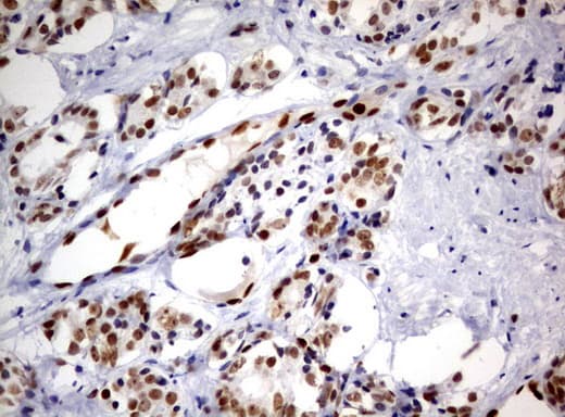 ERG Antibody (clone UMAB76)