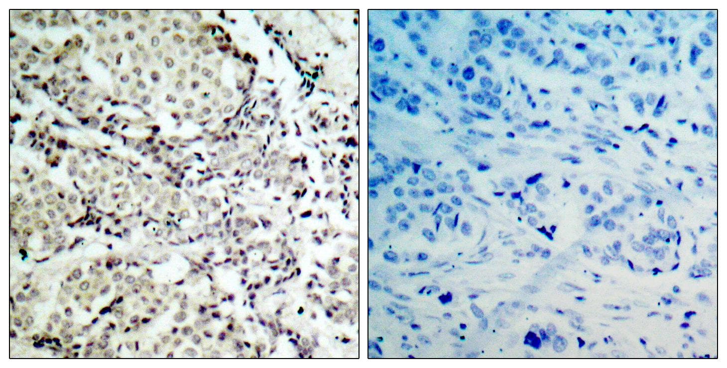 MAP2K3 / MEK3 / MKK3 Antibody (p189)