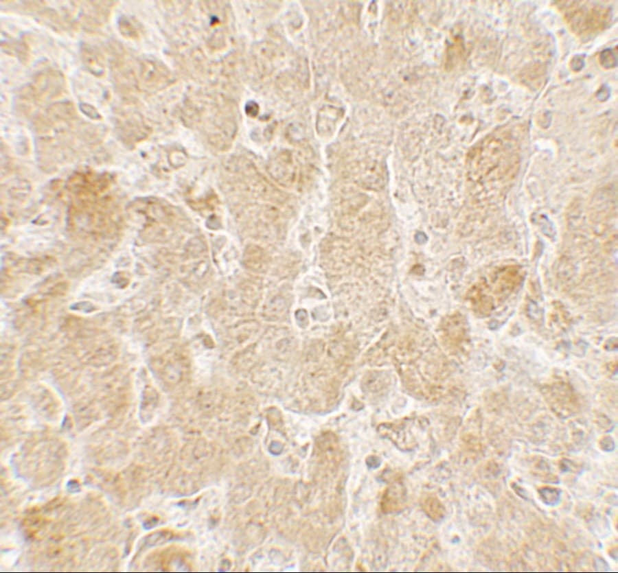 Polyclonal Rabbit anti-Human LAMTOR2 Antibody (IHC, IF, WB)