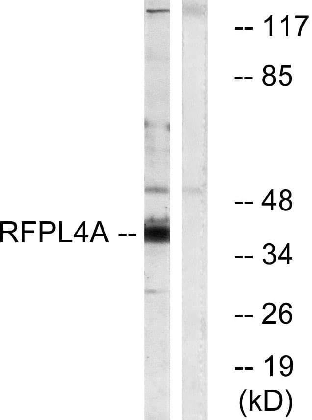 RFPL4A Antibody (aa155-204)