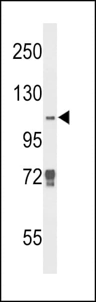 KDM4B / JMJD2B Antibody (aa4-31)