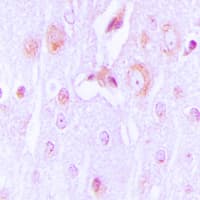 TH / Tyrosine Hydroxylase Antibody (N-Terminus)