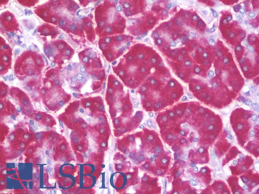 IHC-plus™ Polyclonal Rabbit anti-Human RPS4X + RPS4Y1 + RPS Antibody (aa81-130, IHC, IF, WB)