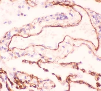 COL4A1 / Collagen IV Alpha1 Antibody (aa1445-1669)