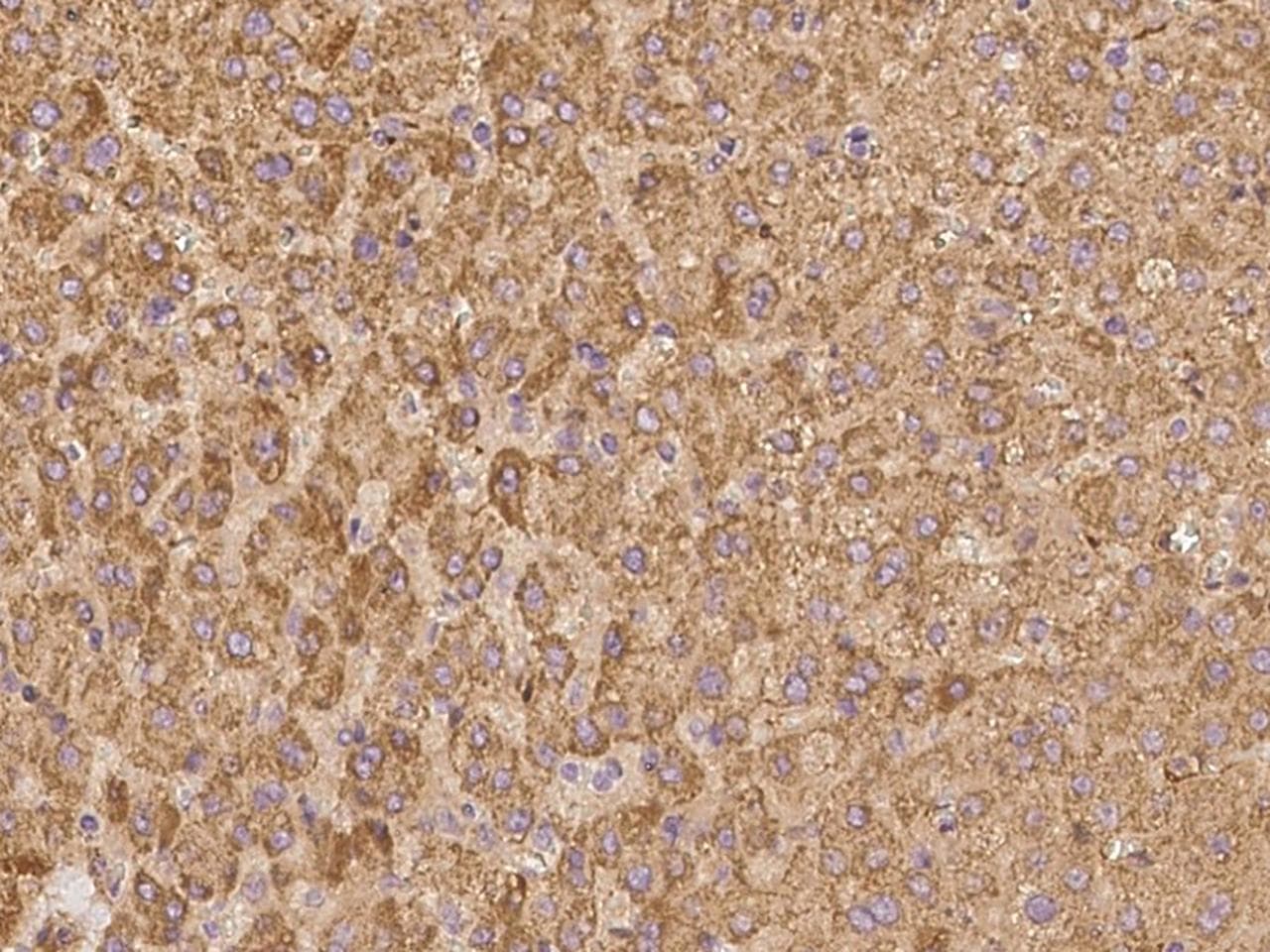 APOC2 / Apolipoprotein C II Antibody