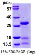Human IDI2 Protein (Recombinant His)