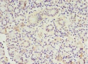 MTRR Antibody (aa1-725)