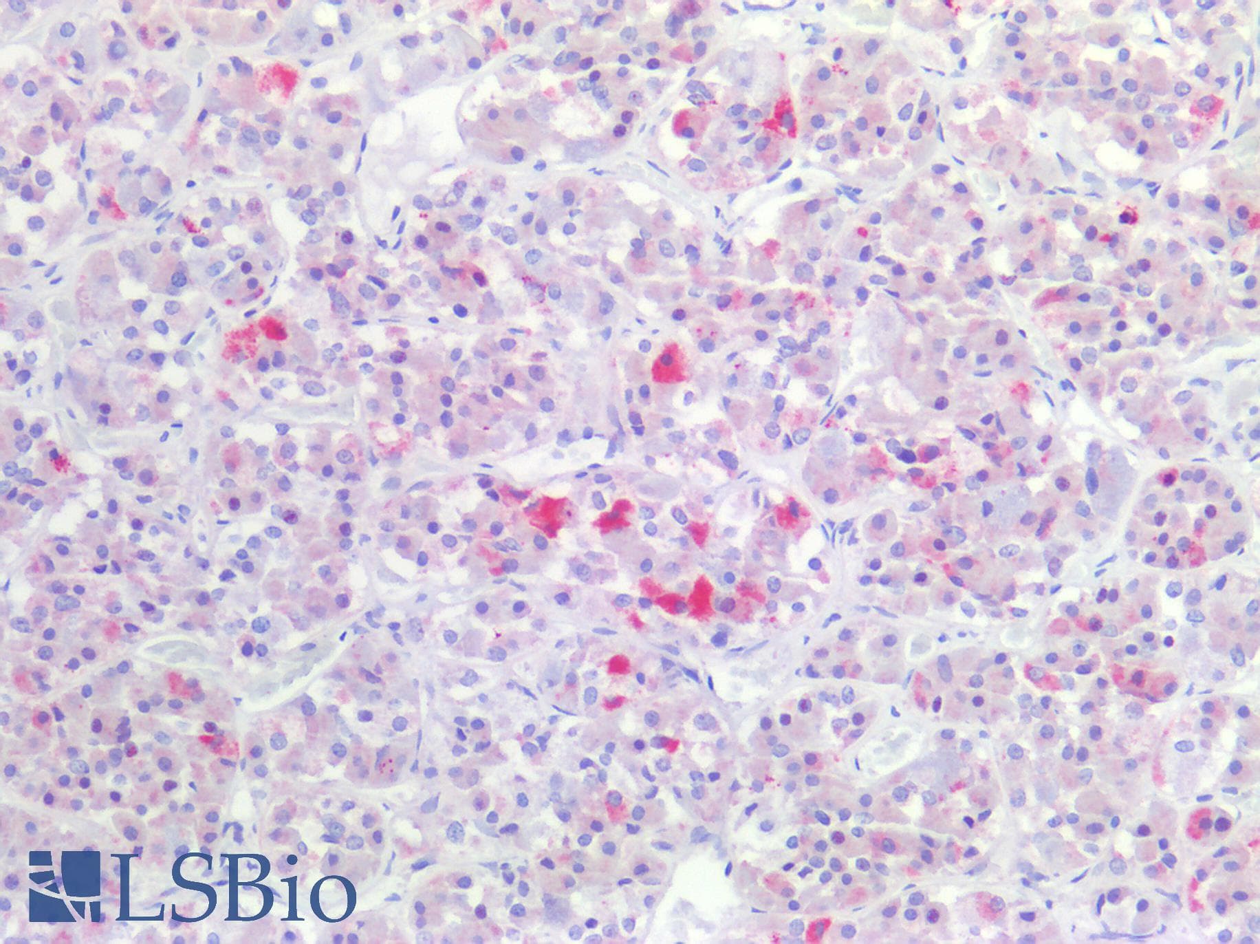 PathPlus™ GnRH receptor / GNRHR Antibody (Cytoplasmic Domain)