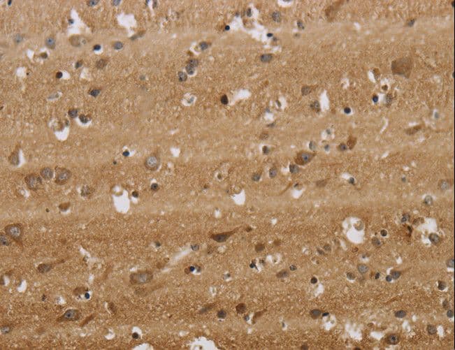 KCNMB2 Antibody