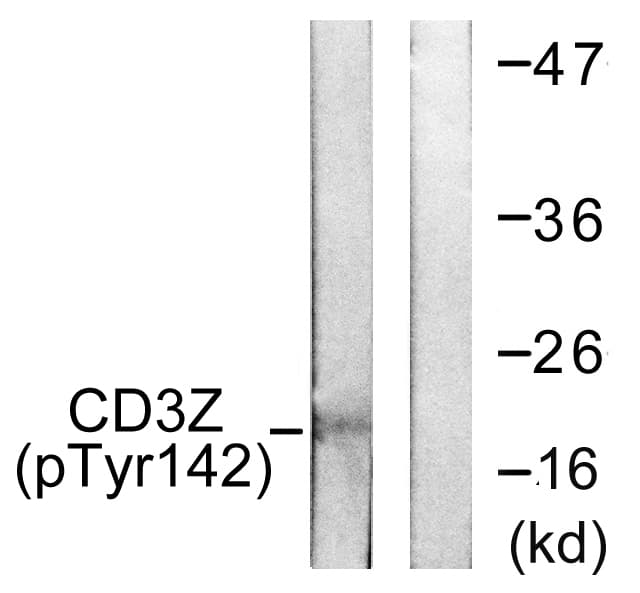CD247 / CD3 Zeta Antibody (phospho-Tyr142)
