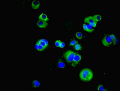 SUSD6 / KIAA0247 Antibody
