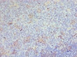 Polyclonal Rabbit anti-Human CD68 Antibody (aa22-319, IHC)