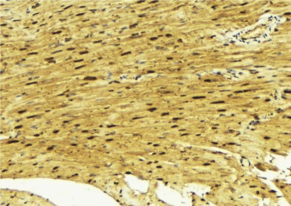 MEF2A / MEF2 Antibody