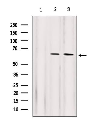 RELA / NFKB p65 Antibody