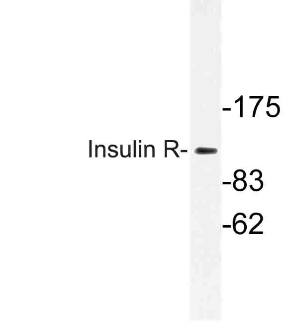 INSR / Insulin Receptor Antibody (Lys1368)