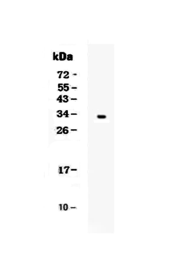 Polyclonal Rabbit anti-Human KLK1 / Kallikrein 1 Antibody (WB)