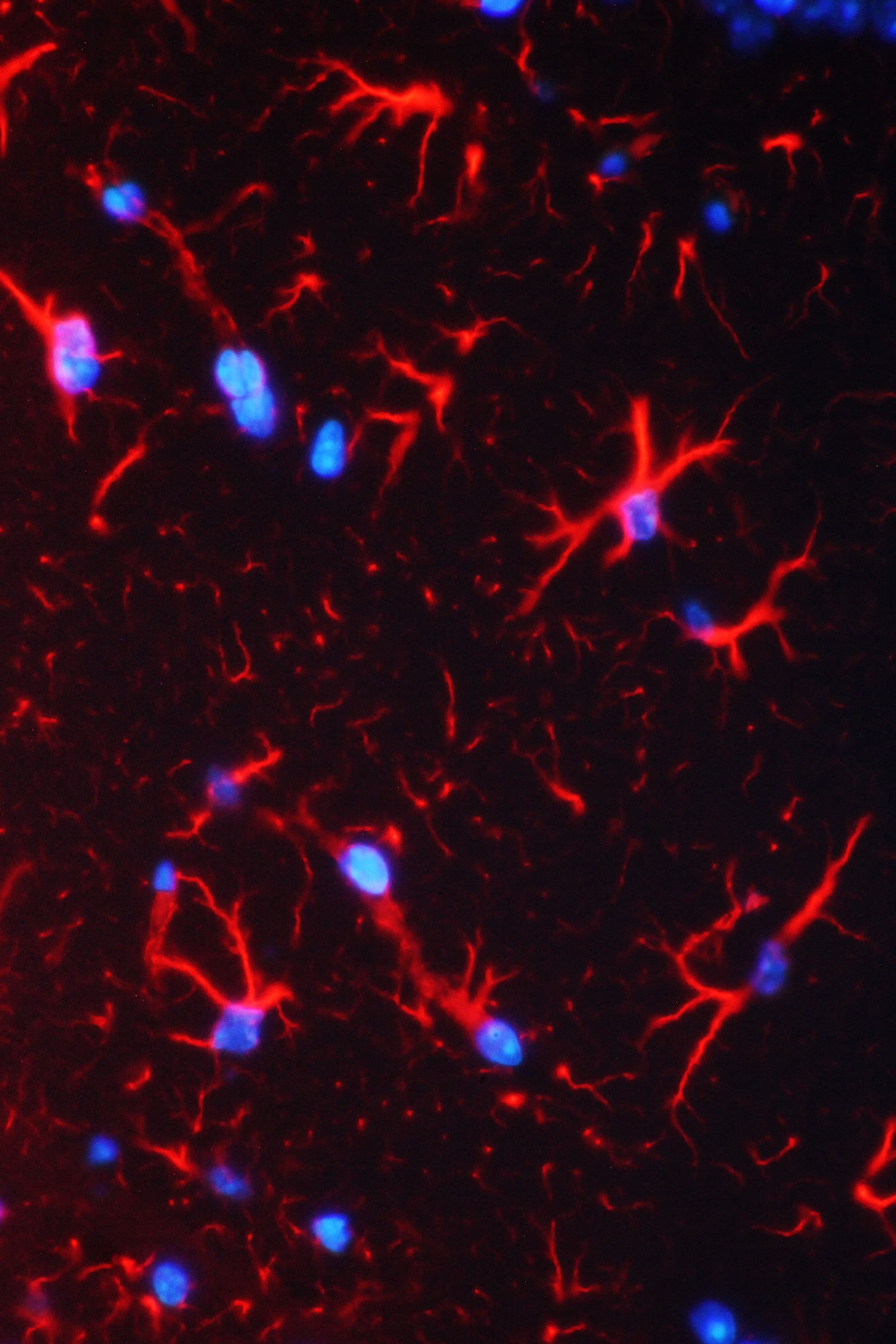 GFAP Antibody (aa93-432)