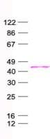 Human PHF13 Protein (Recombinant His, N-Terminal)