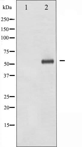 Polyclonal Rabbit anti-Human DOK2 Antibody (phospho-Tyr299, WB)