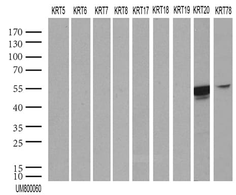 Monoclonal Mouse anti-Human KRT20 / CK20 / Cytokeratin 20 Antibody (clone UMAB167, IHC, WB)