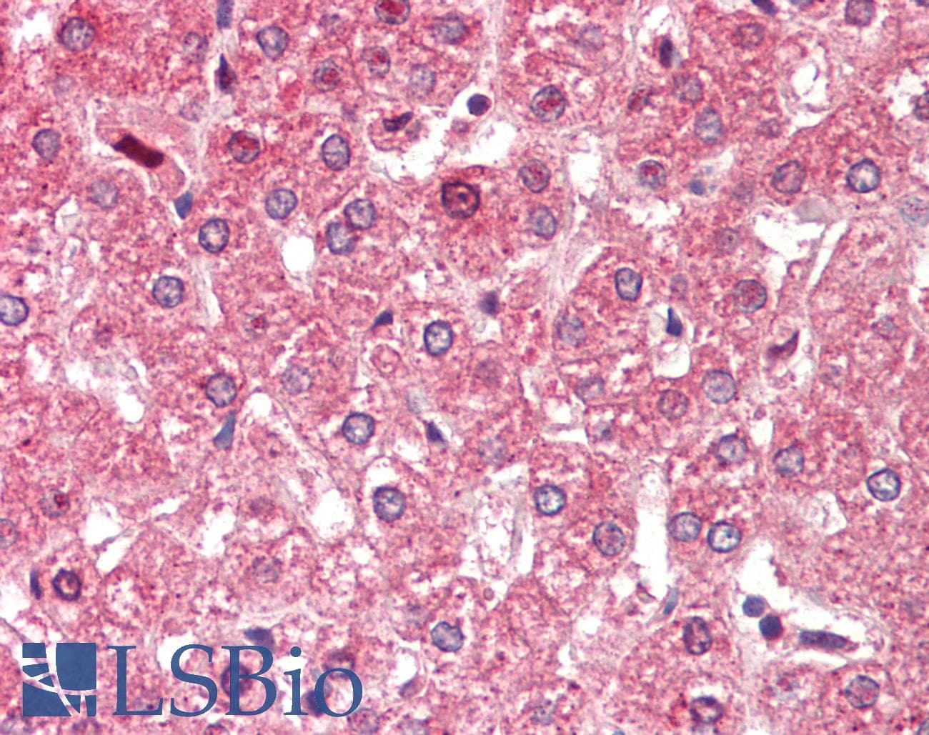 IHC-plus™ ALDH6A1 Antibody (aa487-496)