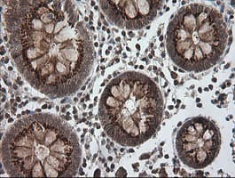 Monoclonal Mouse anti-Human PIK3CG / PI3K Gamma Antibody (clone OTI2B1, IHC, WB)