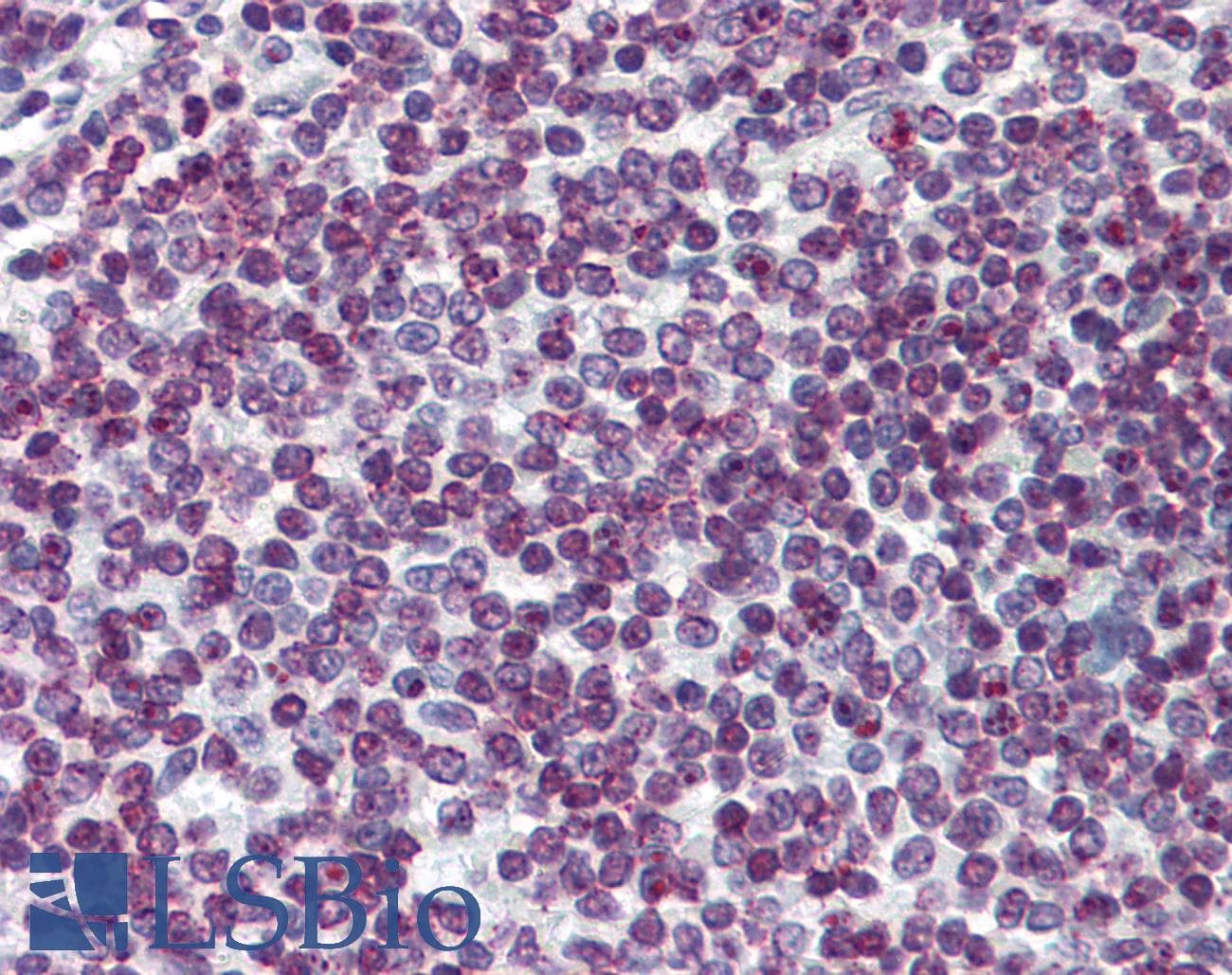 IHC-plus™ Monoclonal Mouse anti-Human FOXO3 / FOXO3A Antibody (clone 2H2, IHC, IF, WB)