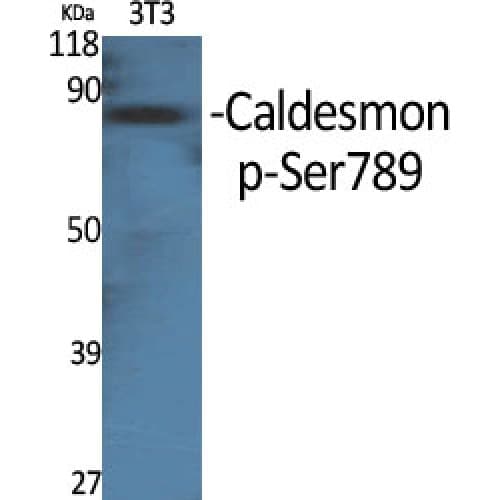 CALD1 / Caldesmon Antibody (730-810 aa)