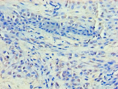 HDAC8 Antibody (aa1-377)
