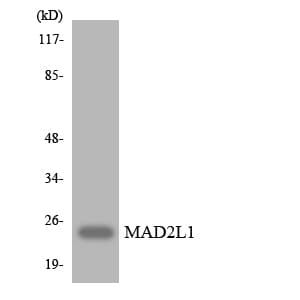 Polyclonal Rabbit anti-Human MAD2L1 / MAD2 Antibody (aa75-124, WB)