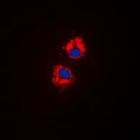 Polyclonal Rabbit anti-Human Cytochrome P450 CYP1A1/2 Antibody (Internal, IHC, IF, WB)