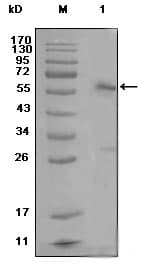 Monoclonal Mouse anti-Human ER Alpha / Estrogen Receptor Antibody (clone 2G112B3, WB)