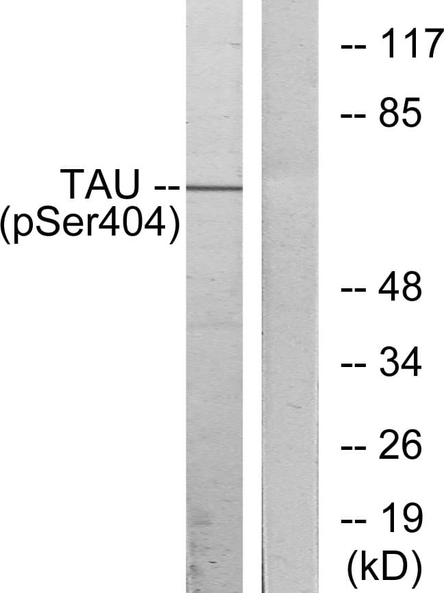 MAPT / Tau Antibody (phospho-Ser404)