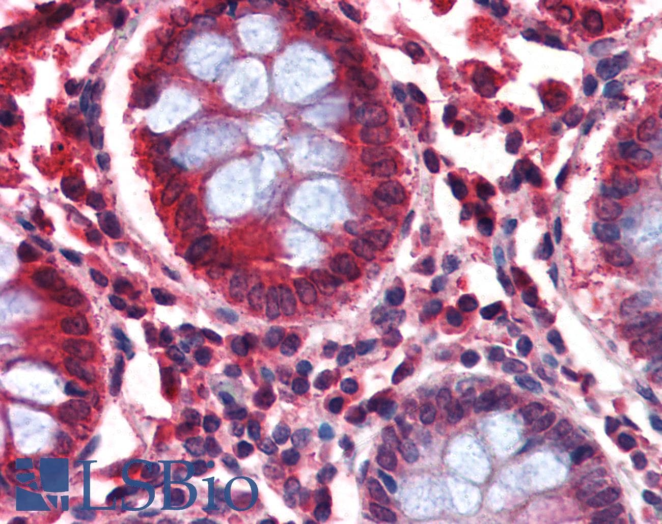 IHC-plus™ Polyclonal Goat anti-Human GAD65 Antibody (aa515-528, IHC, WB)