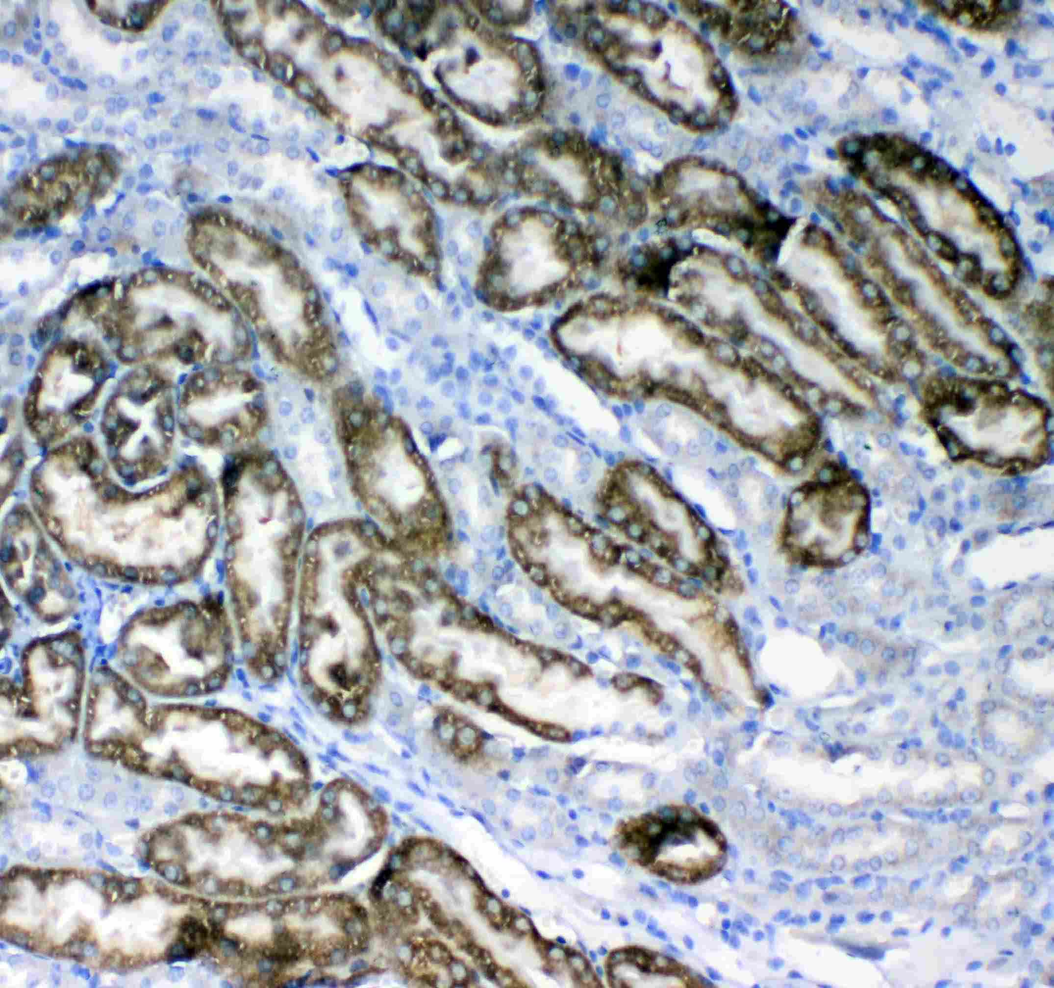 Polyclonal Rabbit anti-Human GK / Glycerol Kinase Antibody (IHC, WB)