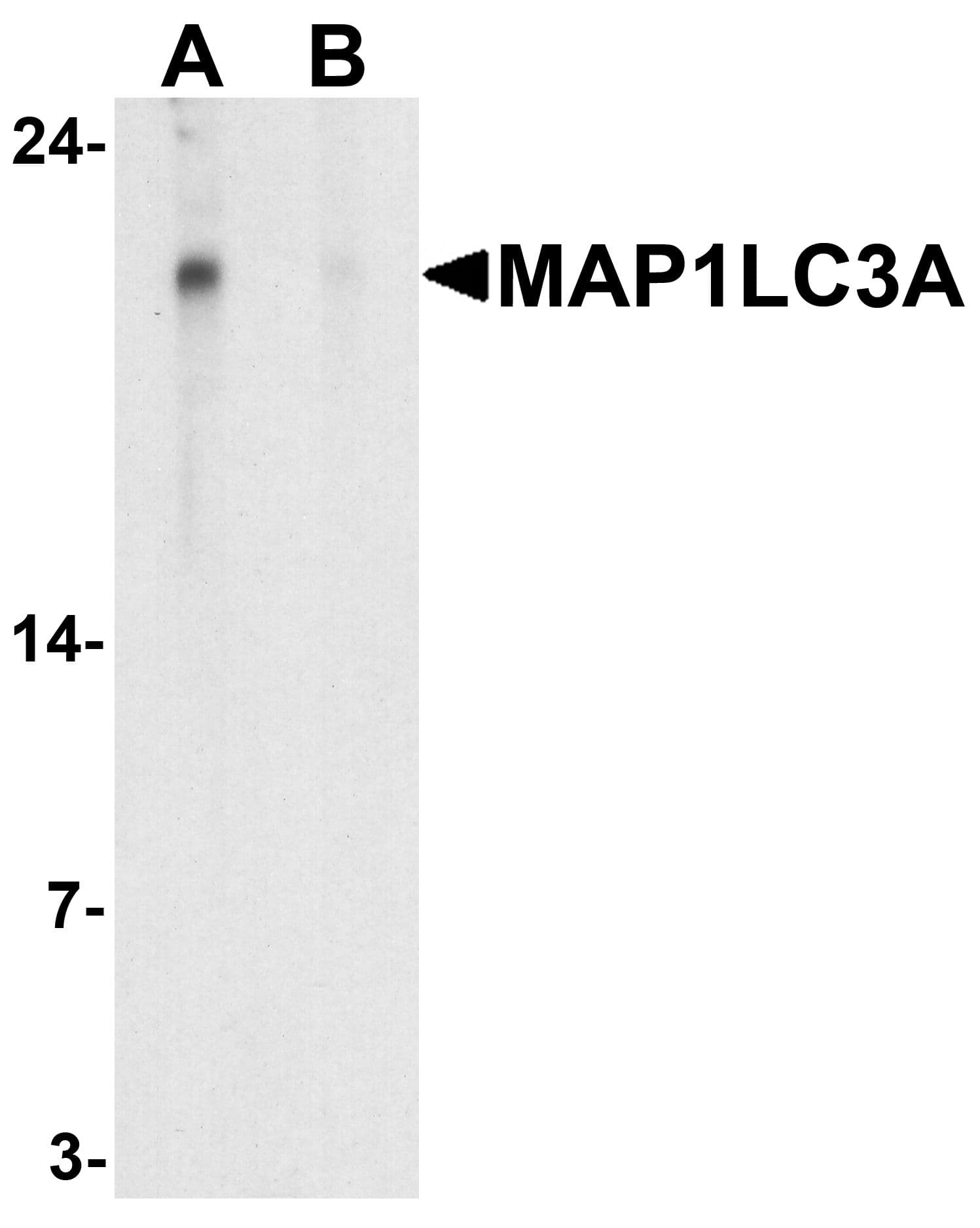 IHC-plus™ MAP1LC3A / LC3A Antibody