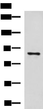 Polyclonal Rabbit anti-Human CCNF / Cyclin F Antibody (IHC, WB)