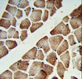ATP5C1 Antibody (aa40-67)