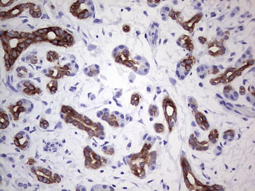 Monoclonal Mouse anti-Human KRT19 / CK19 / Cytokeratin 19 Antibody (clone OTI5F4, aa240-390, IHC, WB)