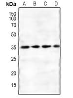 GNB1L / FKSG1 Antibody