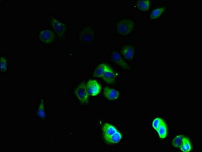 Polyclonal Rabbit anti-Human TSPAN16 Antibody