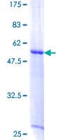 Human XRCC6BP1 Protein (Recombinant GST)