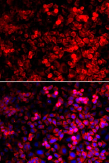 Polyclonal Rabbit anti-Human GLNRS / QARS Antibody (IHC, IF, WB)
