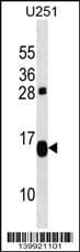 Polyclonal Rabbit anti-Human TP53TG1 Antibody (aa 1-30, N-term, WB)